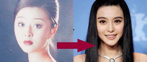 明星网红缝针,勇敢面对伤痛，展现坚强魅力