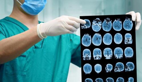 吃瓜爆料17c.ct,吃瓜爆料背后的真相与内幕