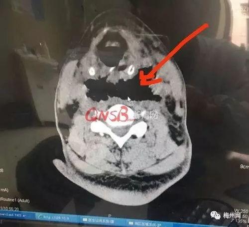 吃瓜爆料17c.ct,吃瓜爆料背后的真相与内幕