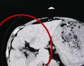 吃瓜爆料17c.ct,吃瓜爆料背后的真相与内幕